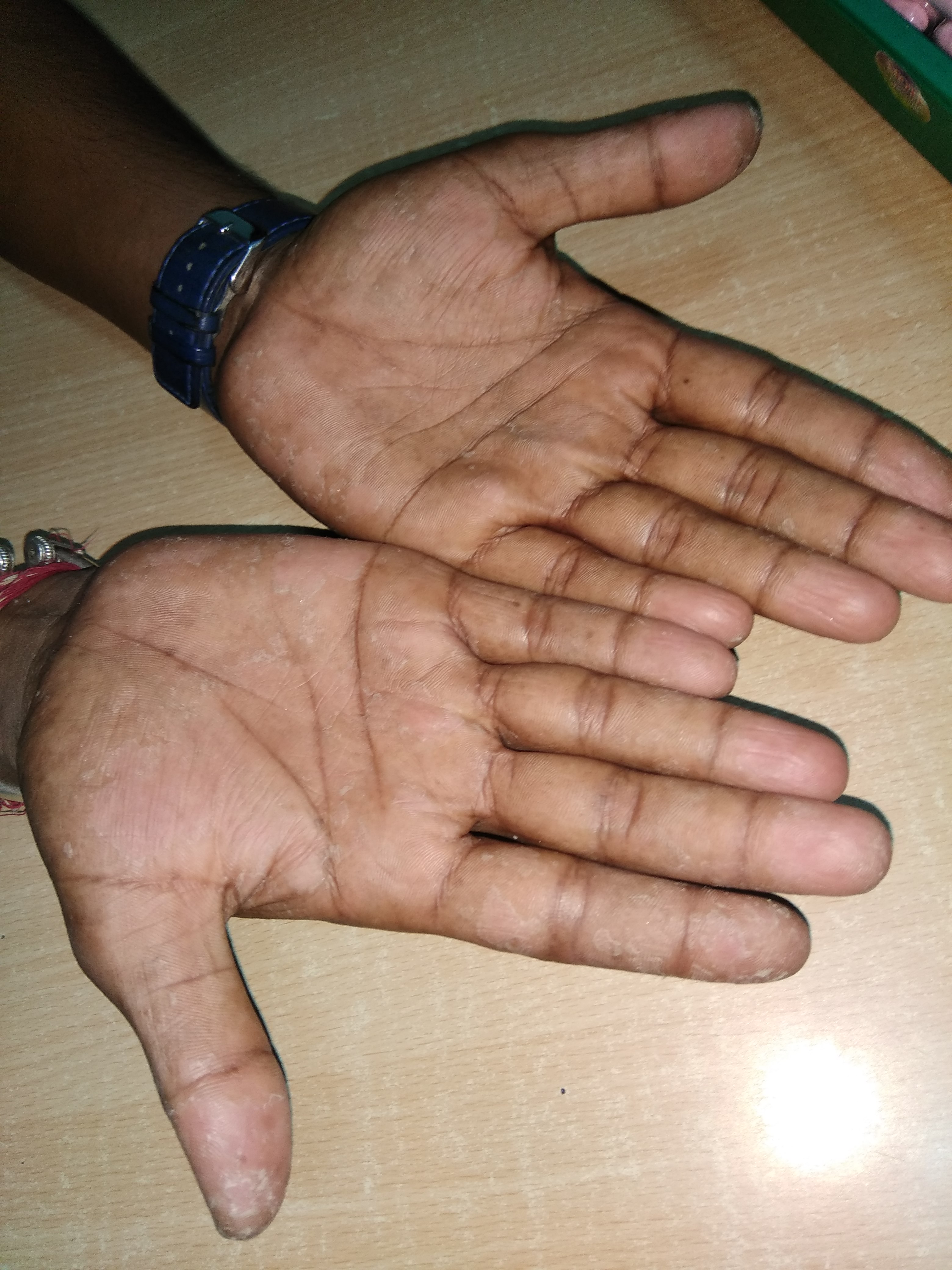 Diagnose The Lesions On Hands