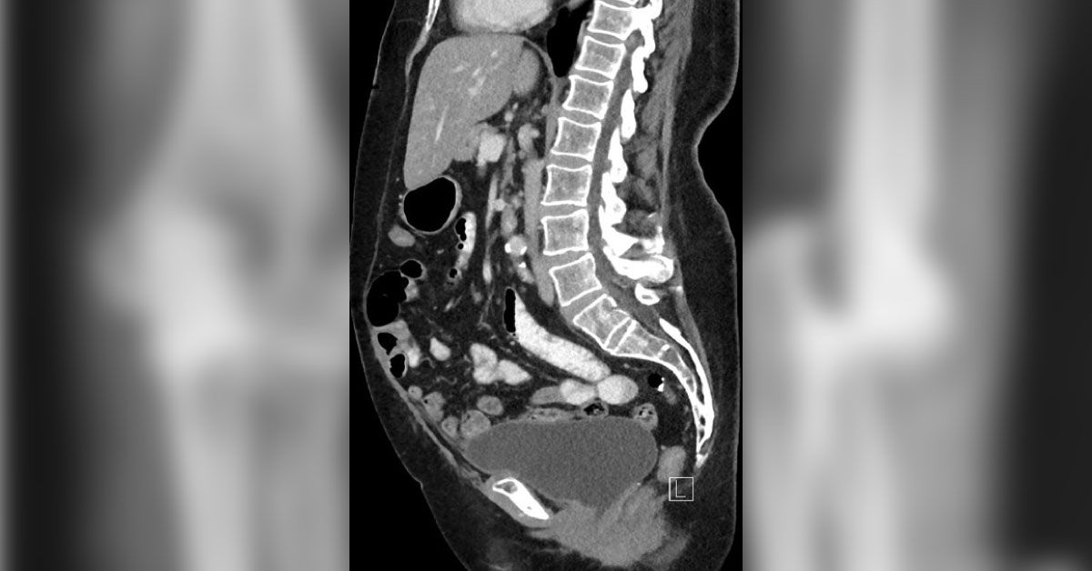 What Is Your Diagnosis?