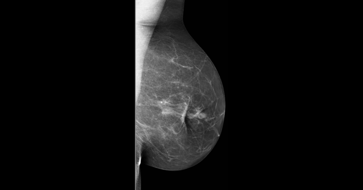 Spot The Diagnosis