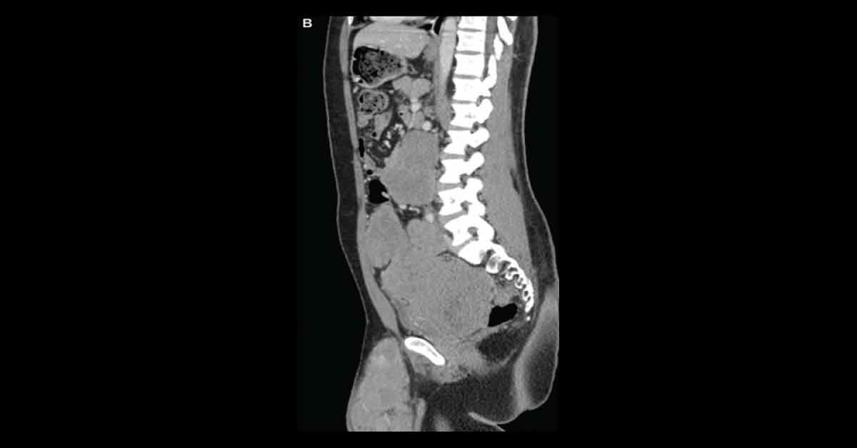 Interpret This CT Scan