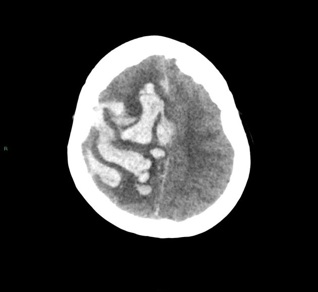 Diagnose This Neurologic Abnormality
