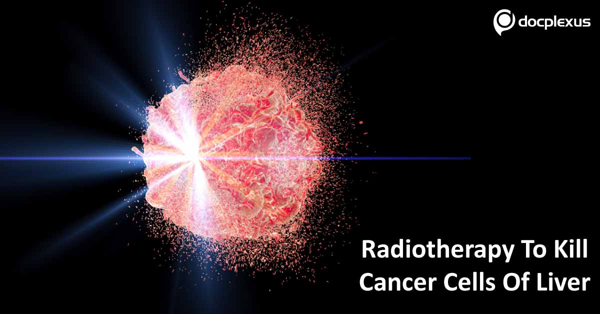Novel Radiotherapy To Treat Liver Cancer