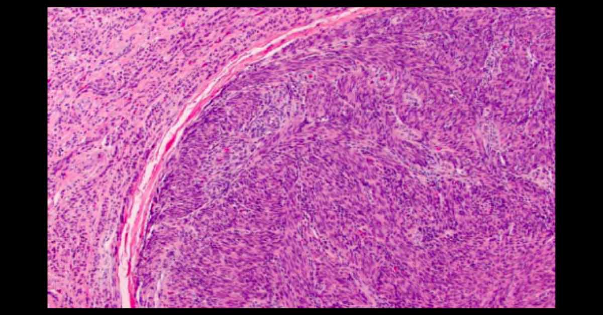 Diagnose The Underlying Condition