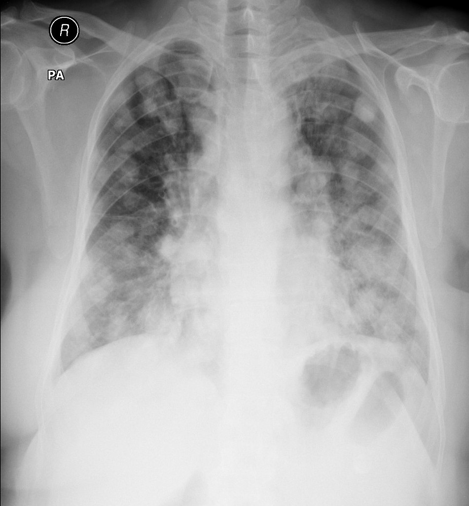 Spot The Diagnosis