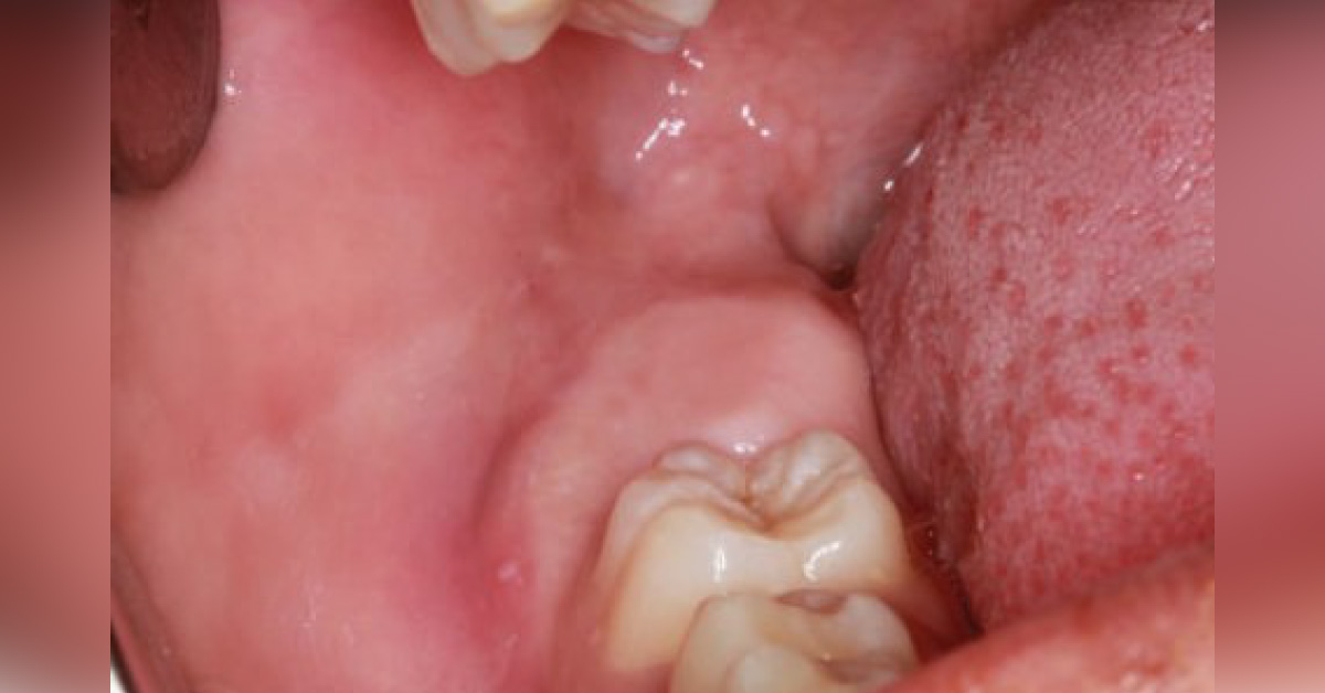 Spot The Diagnosis