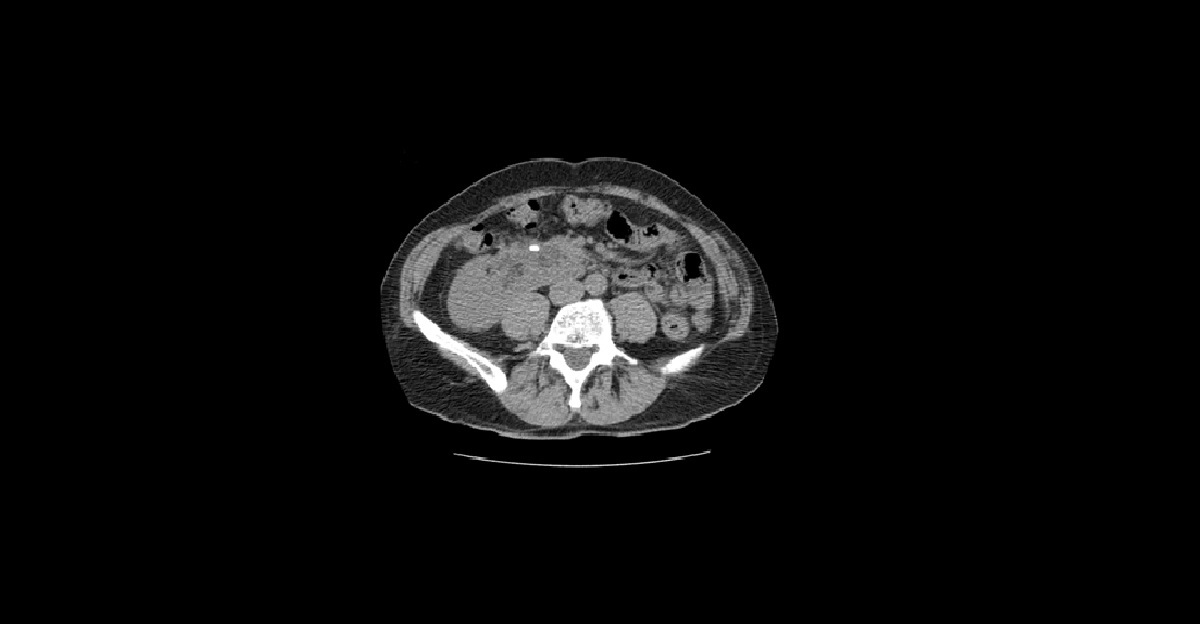 Interpret This CT Scan?
