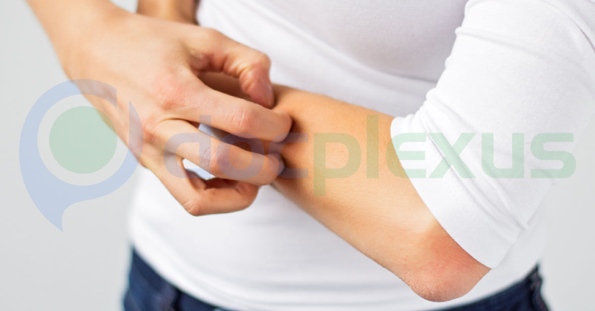 A Case of Progressively Increasing Urticaria