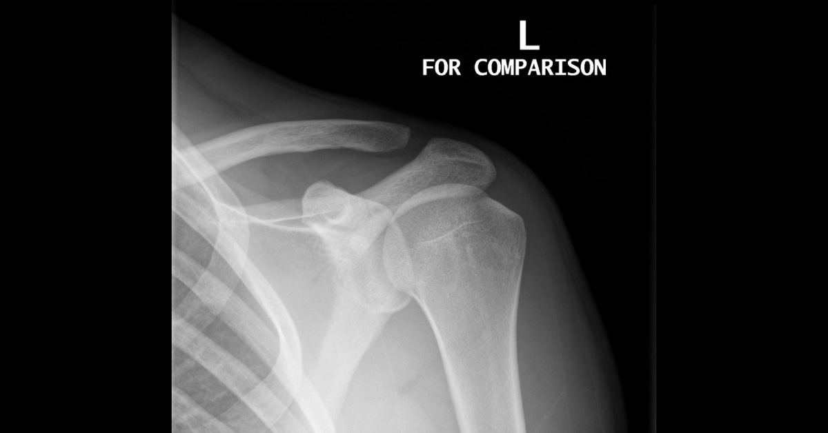 What Does The X-Ray Reveal?