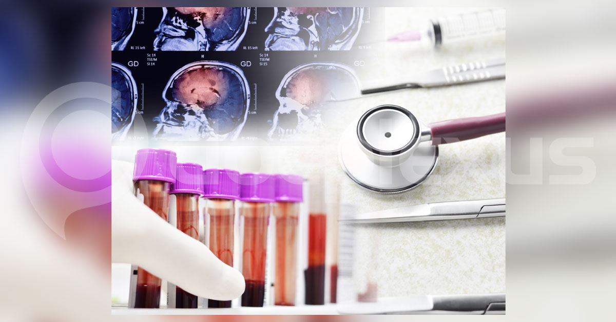 Biomarker For Spontaneous Intracerebral Hemorrhage Based Mortality