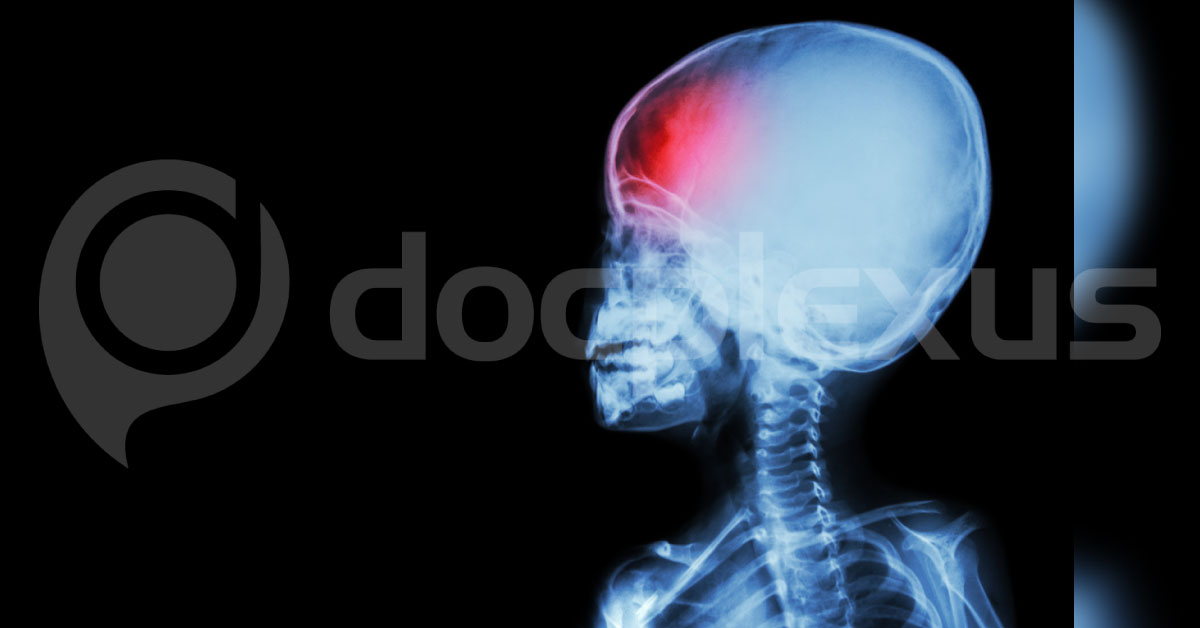 Late Manifestations Of Head Injury