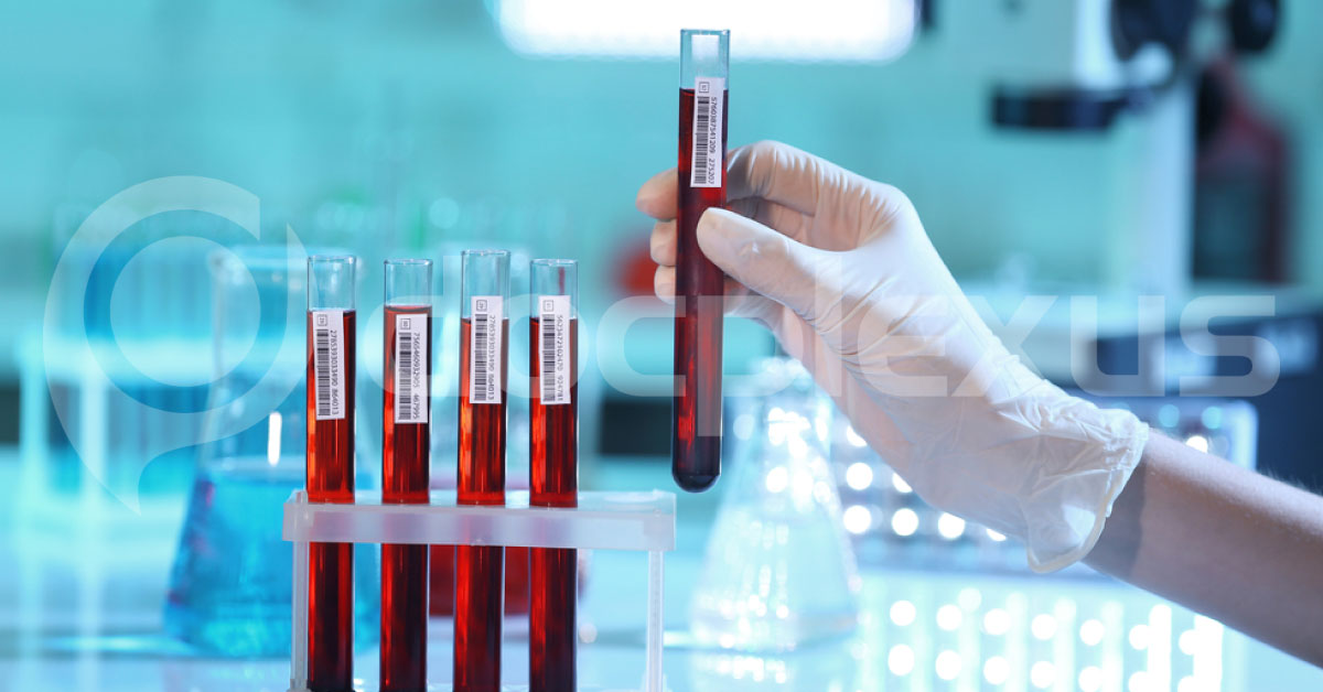All Malaria Parasites Detected By A POD System Using Magnetic Field Of Parasite