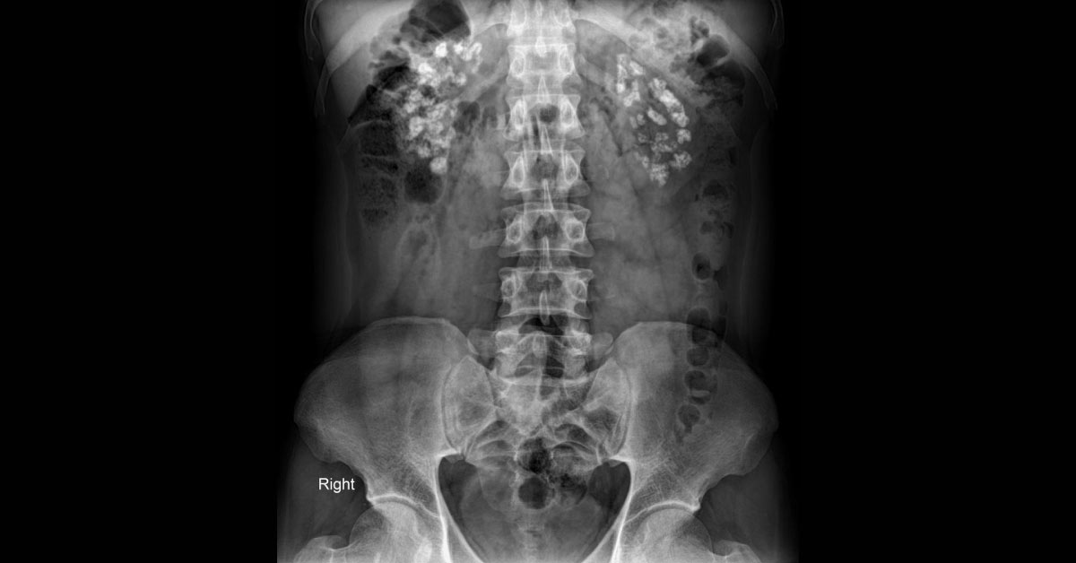 Spot The Diagnosis