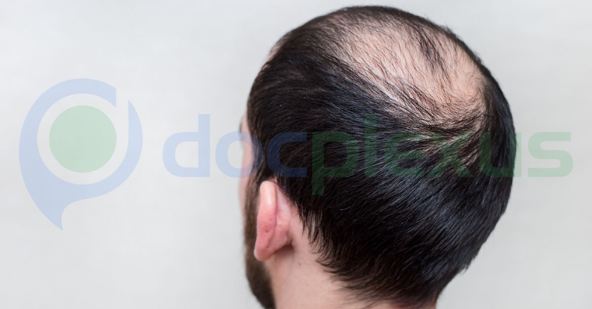 Novel Drug May Help Treat Hair Loss