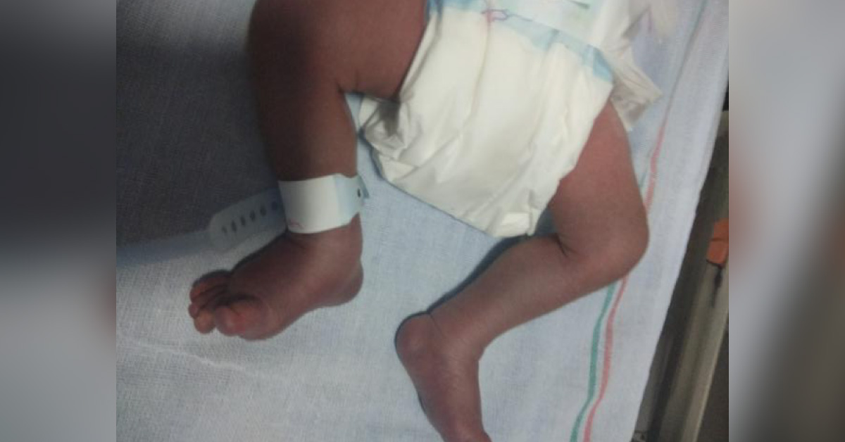 Newborn With Cyanosed Legs