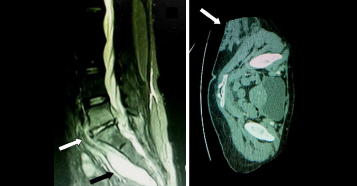 Can You Diagnose This Infection?