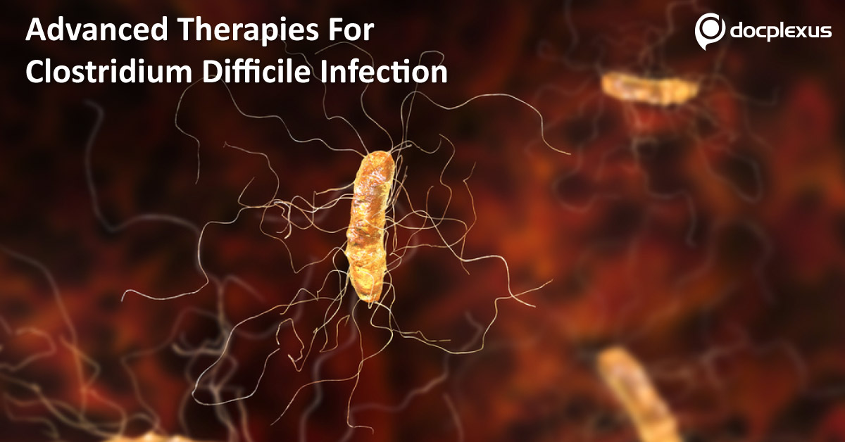 Advanced Therapies For Clostridium Difficile Infection