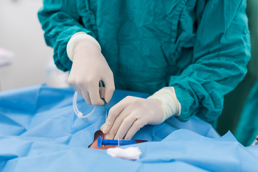 Carotid Stenting