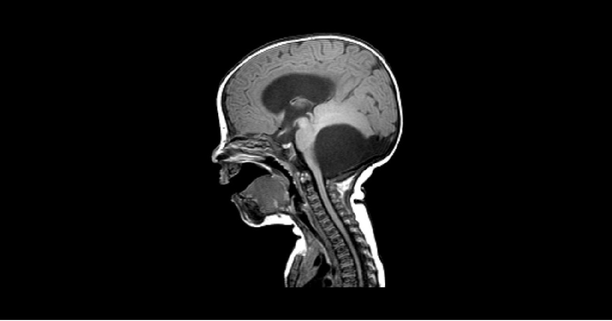 Find The Abnormality In This Child?