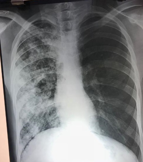 Discuss This X-Ray Chest