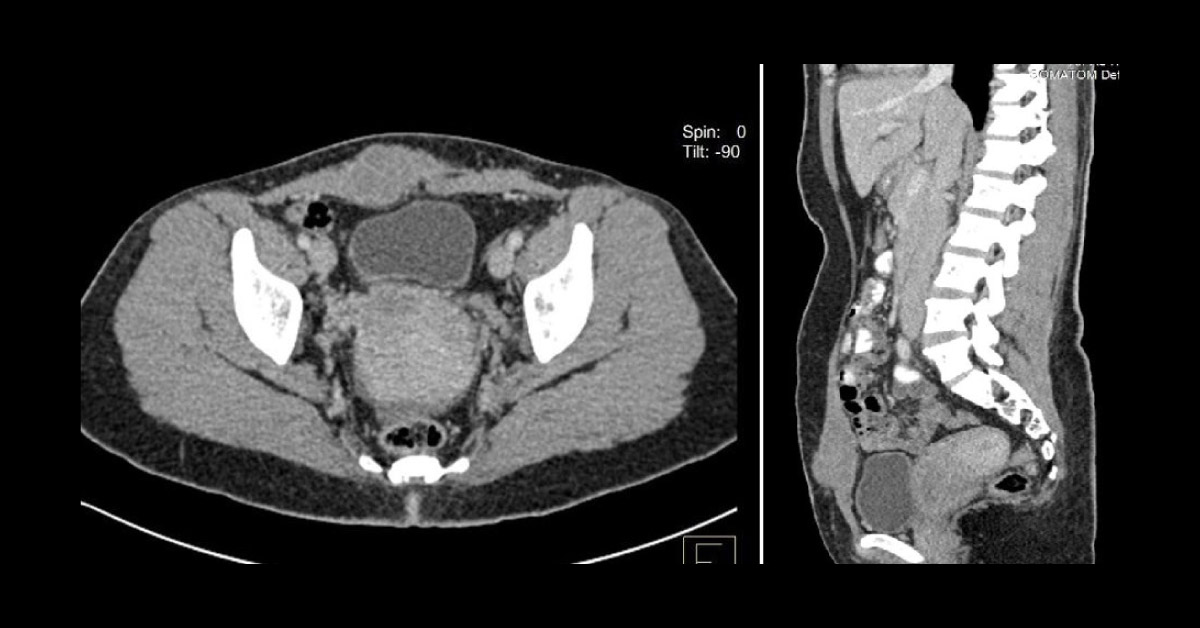 What is Your Diagnosis?