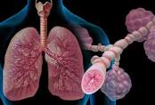 Eczema Drug 'Dupilumab' Effective Against Severe Asthma Restoring Lung Function