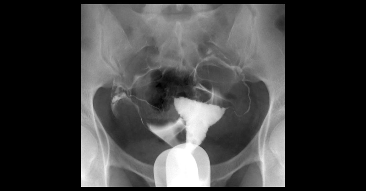 Interpret These Radiological Findings