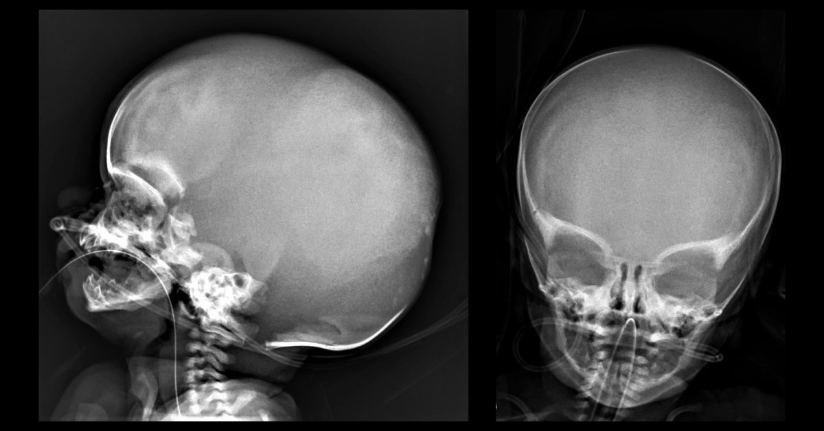 Identify This Abnormality in the Newborn