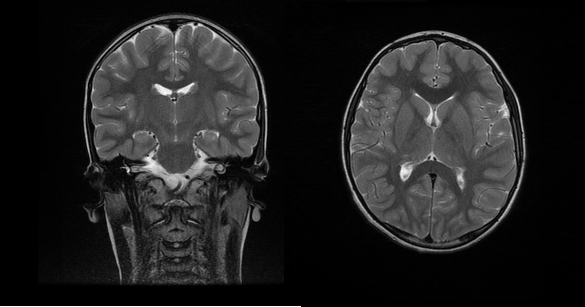 Diagnose This Pediatric Case?