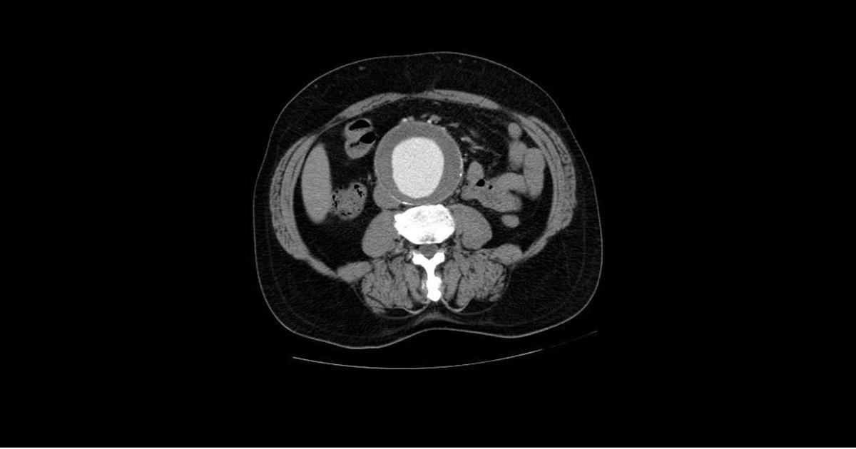 Diagnose This Cardiology Case?