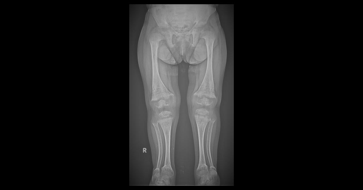 Interpret This X-Ray Image?