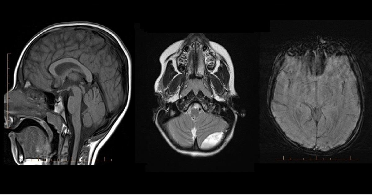 Diagnose This Pediatric Case?