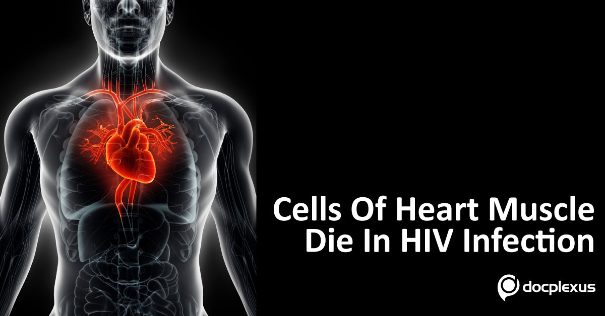 HIV Infection In The Acute Phase Kills The Cells Of Heart Muscle