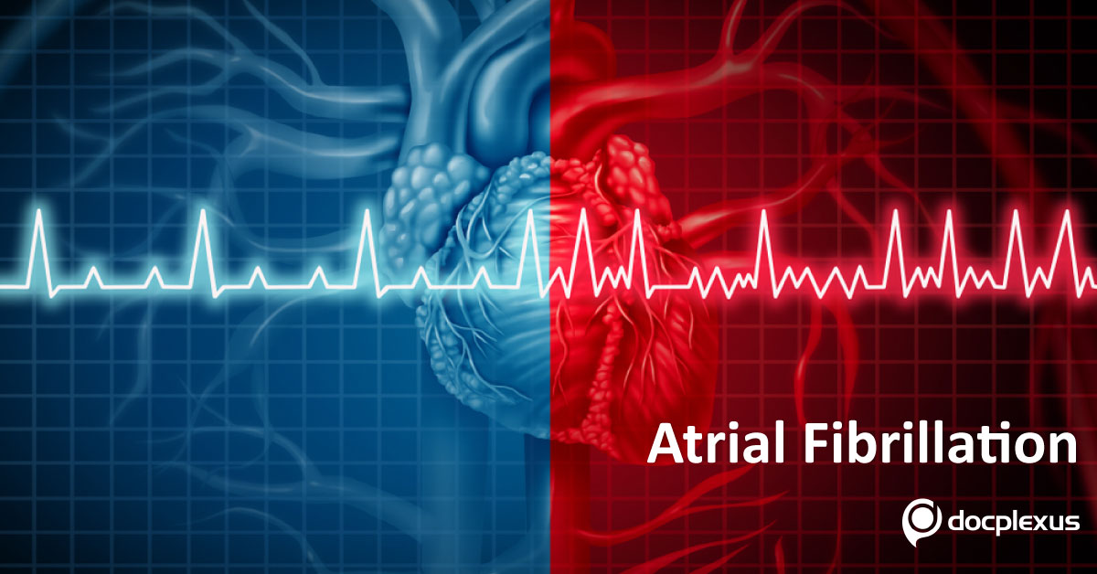 Cardioversion In Patients With Atrial Fibrillation