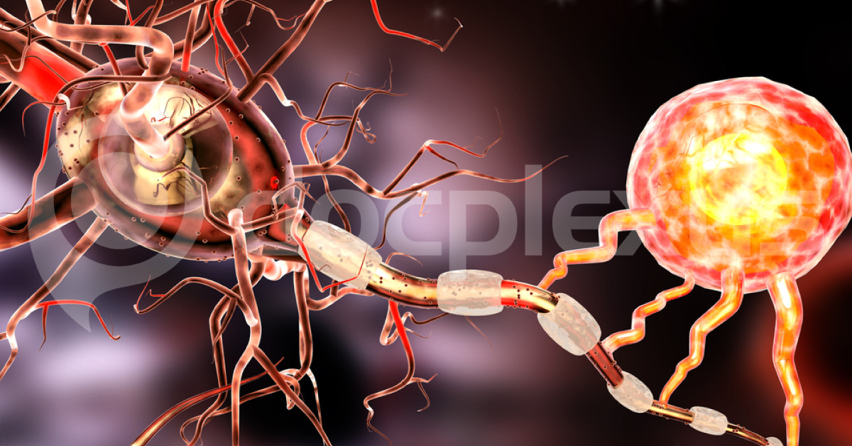 Air Pollution As A Cause Of Brain Autoimmunity