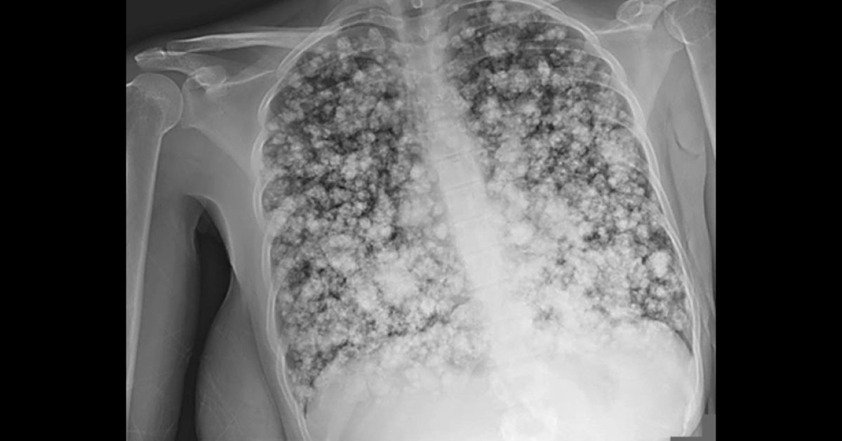 What Does The Radiograph Reveal?