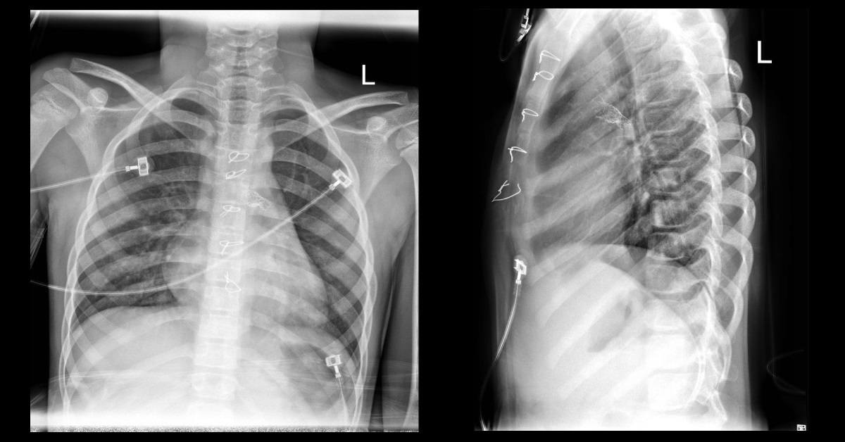 Diagnose This Cardiology Case?