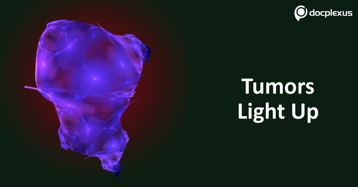 Pill That 'Lights Up' Tumors