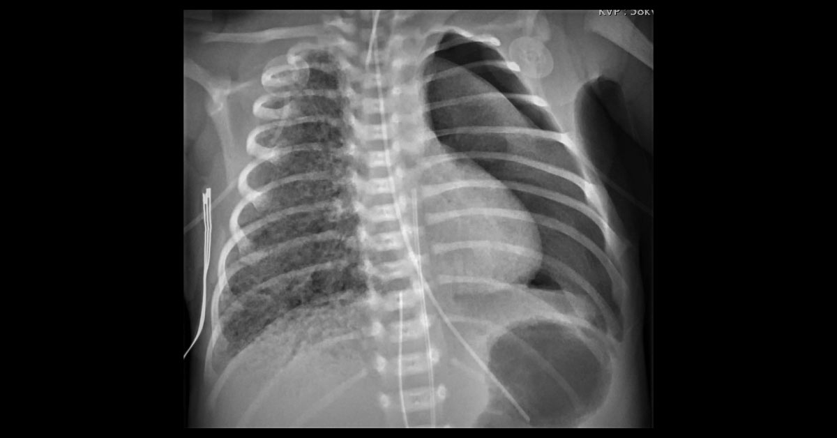 What Is Your Diagnosis?