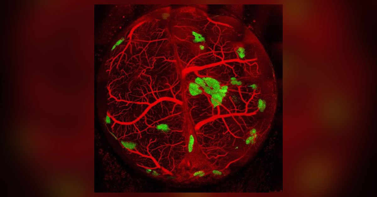 Tissue-Engineered Human Pancreatic Cells Successfully Treat Diabetic Mice
