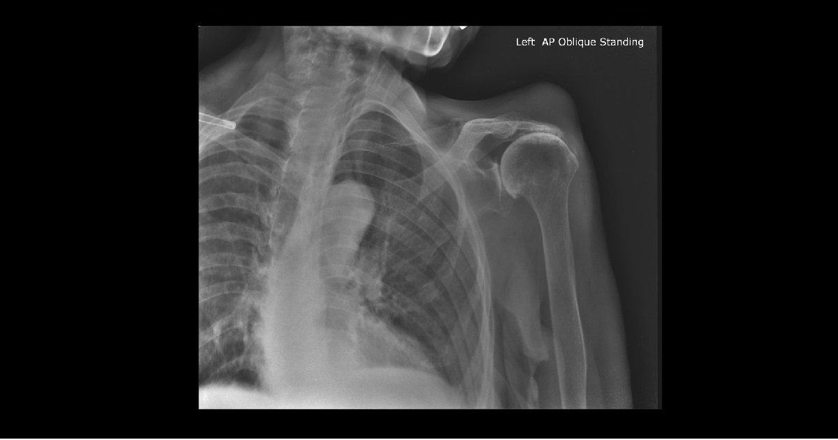 Diagnose This Geriatric Case?