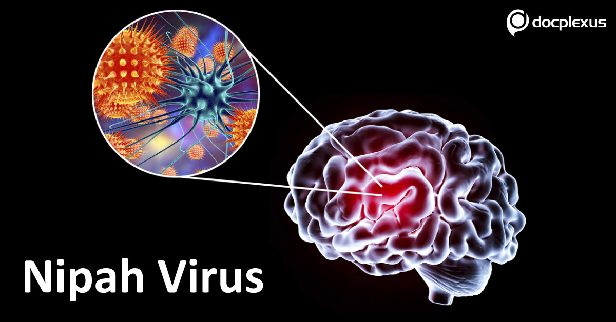 Endemic Nipah Virus Killed 16 Persons In Kerala Including Nurse As It Killed Many In Siliguri In West Bengal