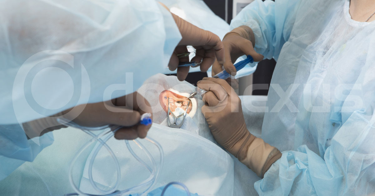 How To Proceed With Intraocular Surgery