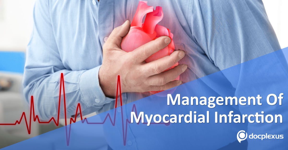 Management Of Acute Myocardial Infarction