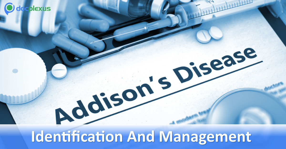 Identification And Management Of Addison’s Disease