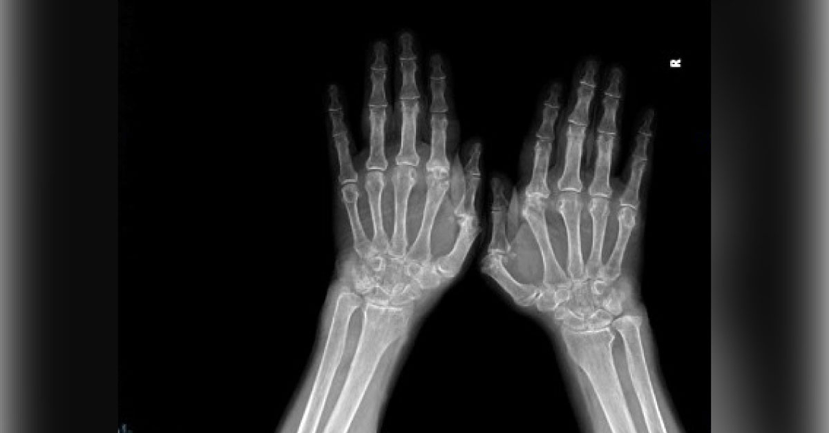 Can You Diagnose This Condition in the 50-year-old Woman?