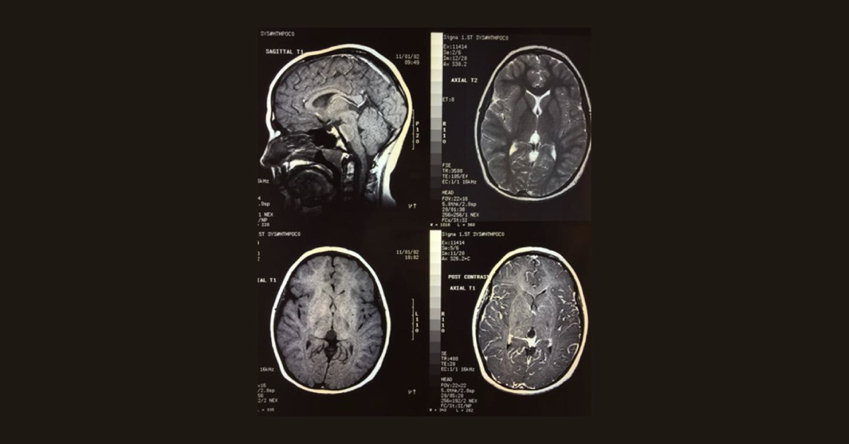 Brief Review On Abuses Of MRI And CT Scans