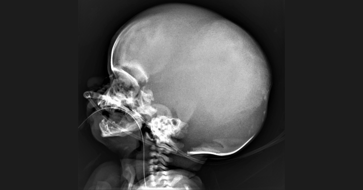 Diagnose This Pediatric Case