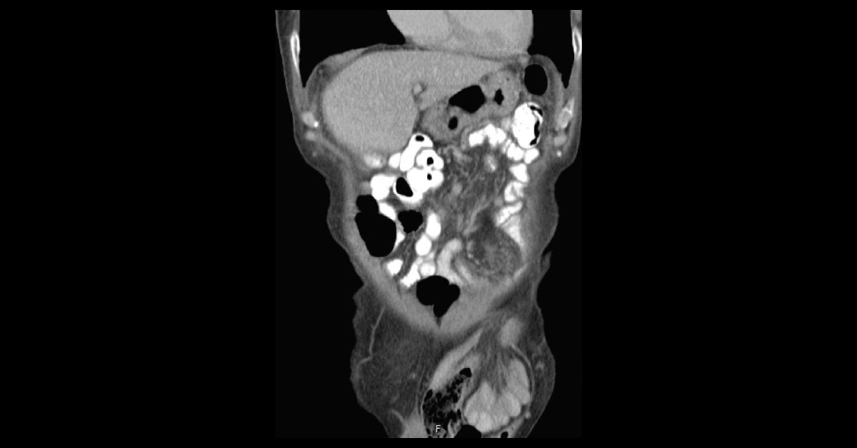 What is Your Diagnosis?