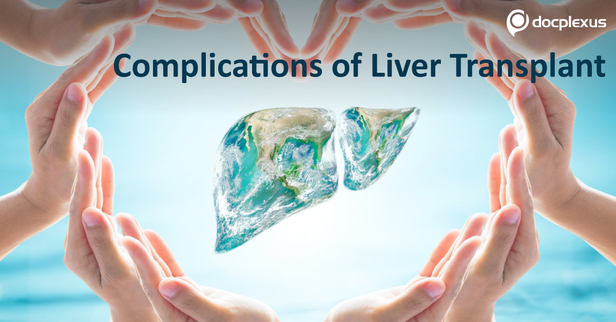 Metabolic And Cardiovascular Complications After Liver Transplant