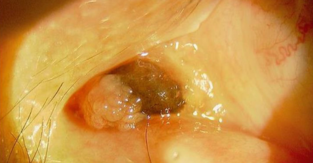 Can You Spot the Condition?